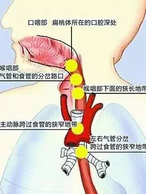 丧命式自救后巨大鱼刺直扎男子心脏