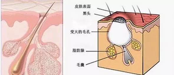 皮肤发红长痘怎么办