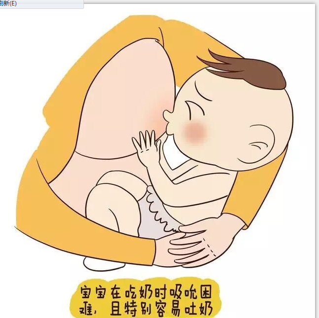 1,宝宝在吃奶时吸允困难,且特别容易吐奶时,应及时带宝宝去医院检查