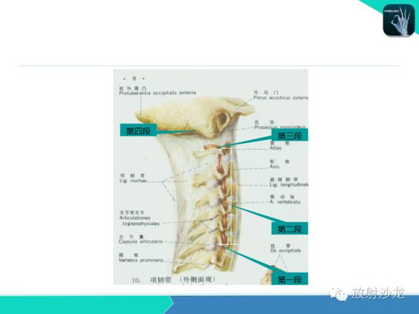 颈椎的影像诊断!