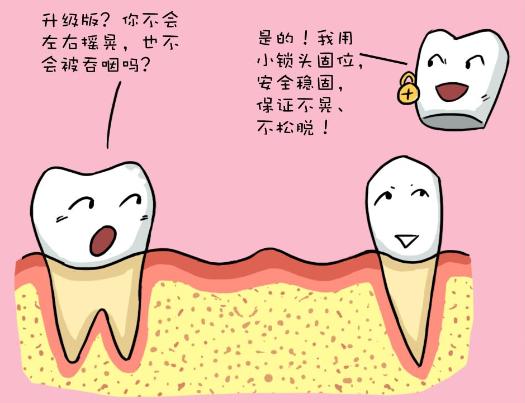 无挂钩假牙,牢牢固位防止误吞!