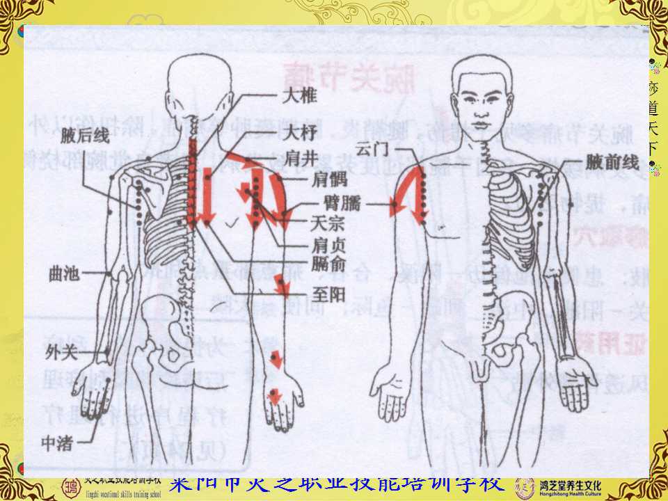 肩周炎刮痧理疗