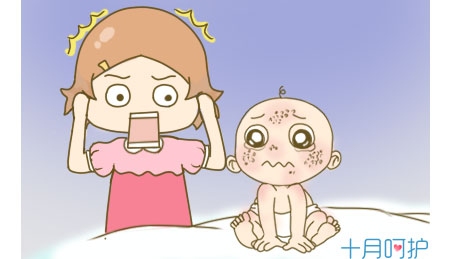 宝宝脸上出现热痱子,宝妈该怎么办?