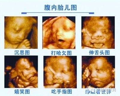 四维彩超检查对有胎儿什么作用