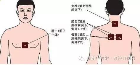 新疗程,新组方,精配穴,多手段,湖南中医附一"三伏六贴