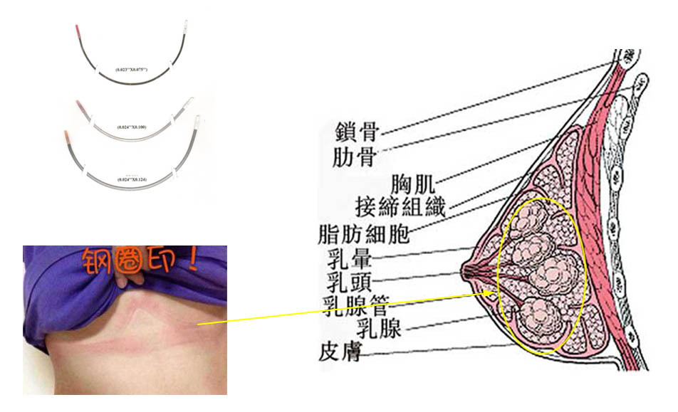 乳腺b超要脱内衣吗(3)