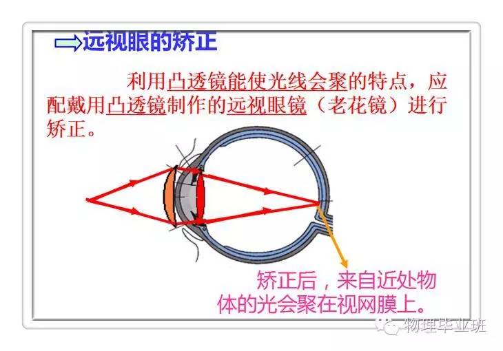 六图解决眼睛近视远视问题中学物理