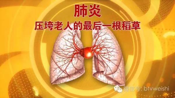 京医出镜|北京医院呼吸与危重症医学科副主任