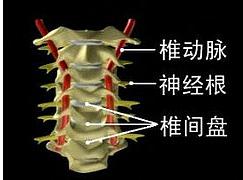 椎动脉被持续牵拉了4个小时,椎间孔被持续挤压了4个小时,颈椎的棘间