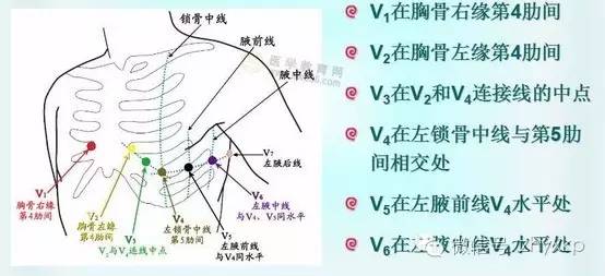 胸导联:胸骨右侧第四肋间,胸骨左侧第四,第五肋间,以及左侧锁骨中线与