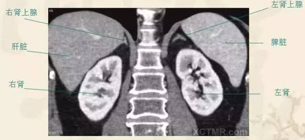 胸部+腹部CT基础图谱,还有不懂的吗?