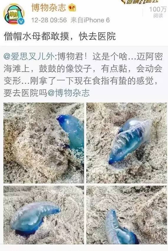 被海蜇咬了怎么办