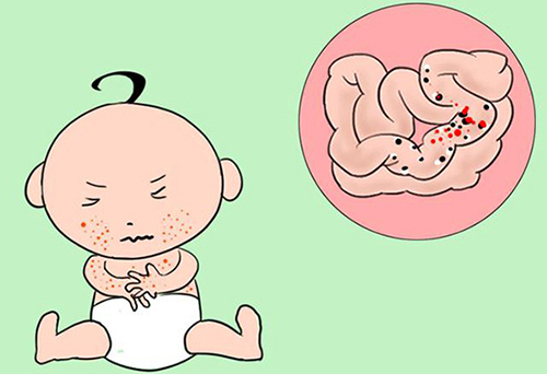 宝宝牛奶蛋白过敏怎么办?