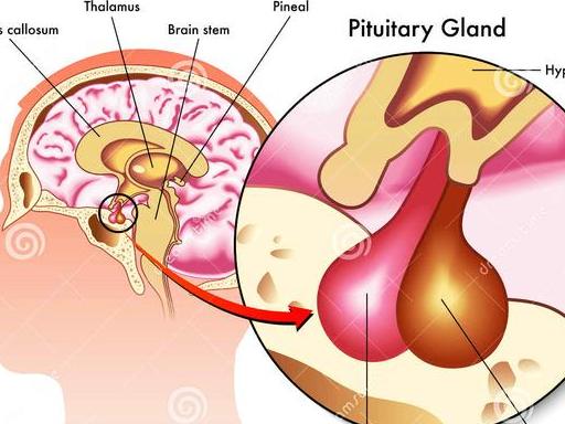 脑垂体瘤的规范诊治