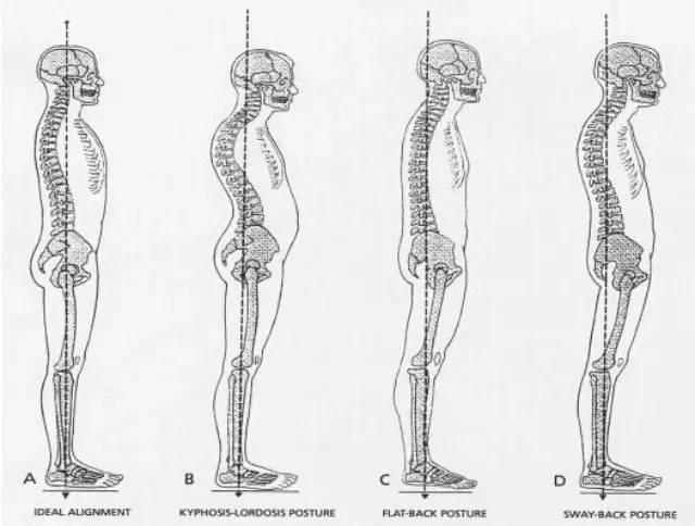 已获授权 理想的姿势是当人体挺直站立时,耳垂(颞骨乳突),肩峰,躯干