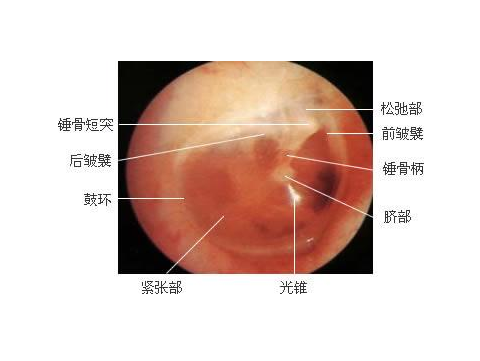 宜兴锦绣菜场杰闻助听器: 鼓膜的观察方法及内容