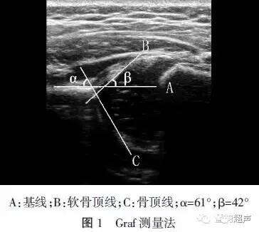 分享:正常婴儿髋关节的超声测量与特征