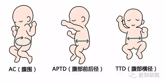 教你看懂:"b超大排畸"检查单