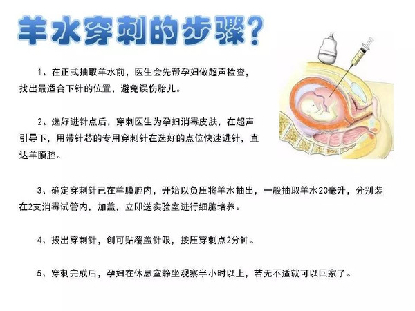 别着急,有这份攻略在手,羊水穿刺步骤全知道!