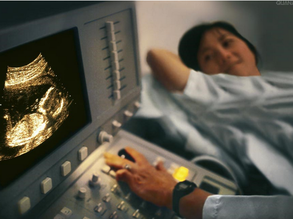 孕早期b超检查宜控制在5分钟内