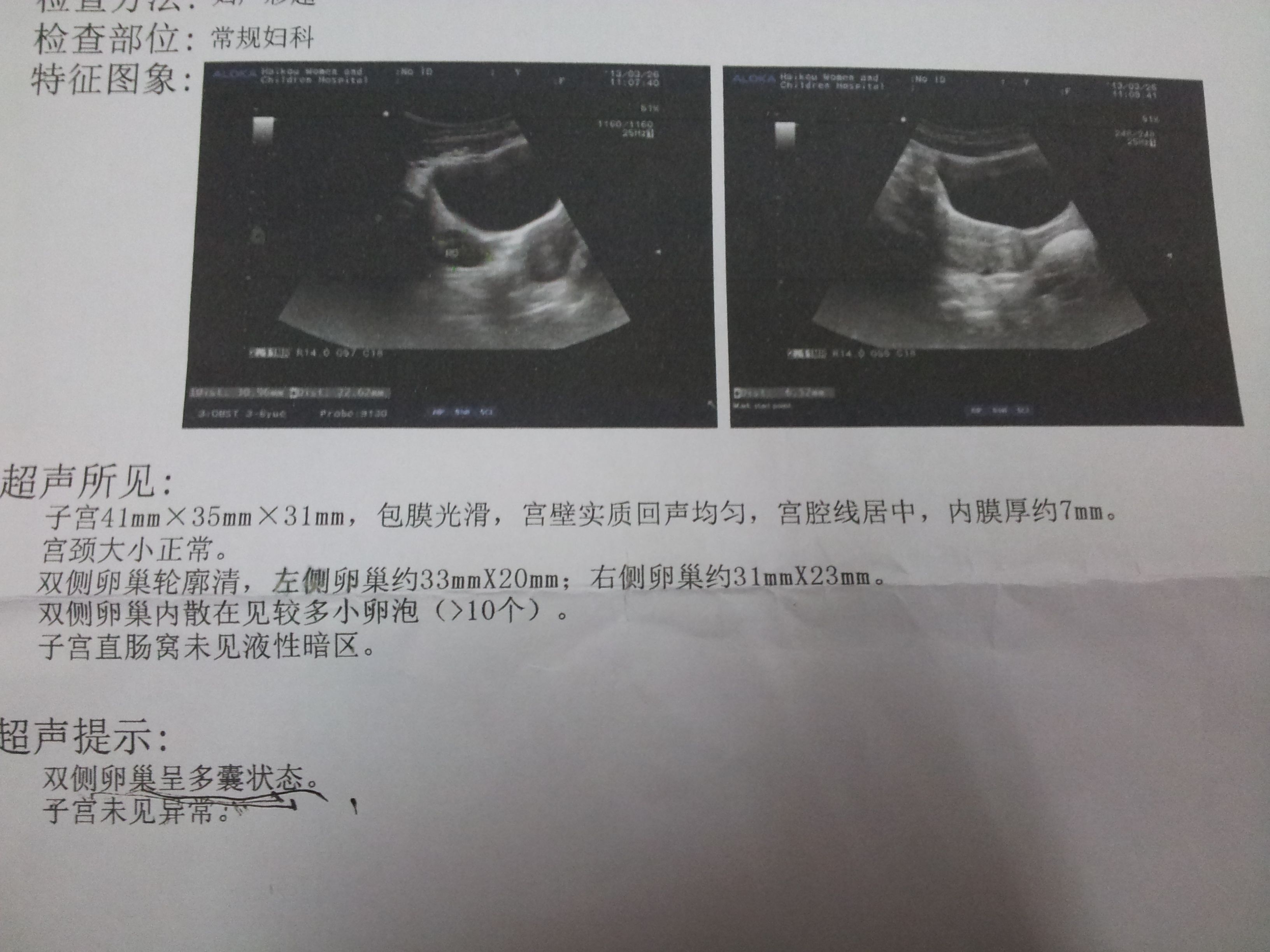 ,孕三个半月胎儿图,孕7个半月胎儿图,孕6个半月胎儿图--早教700网