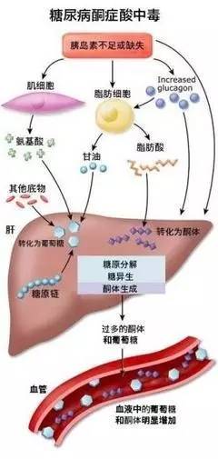 糖尿病人口中酮体味_醛和酮在生活中的应用