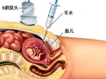 唐筛没有做怎么办