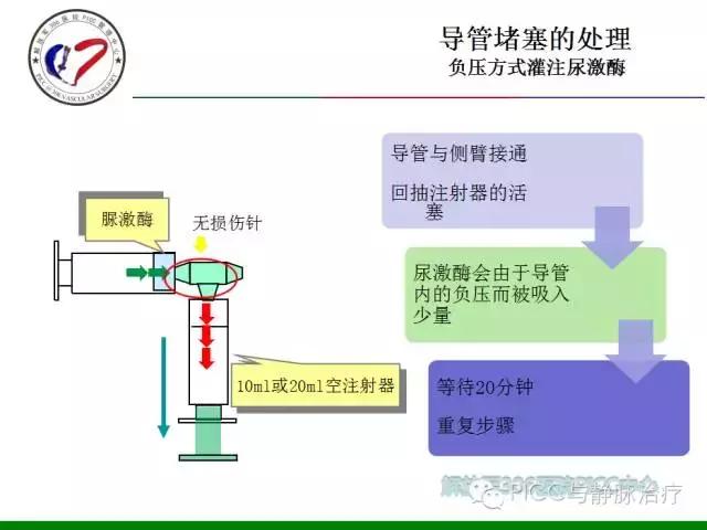 完全植入式输液港的临床应用与管理