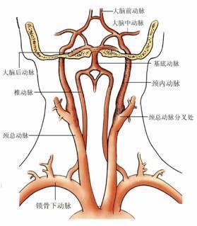 造成颈动脉斑块的原因及危害