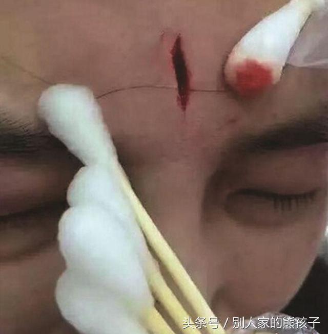 婴儿咳嗽不吃药怎么办