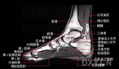 精彩幻灯:踝关节正常 mri 图谱