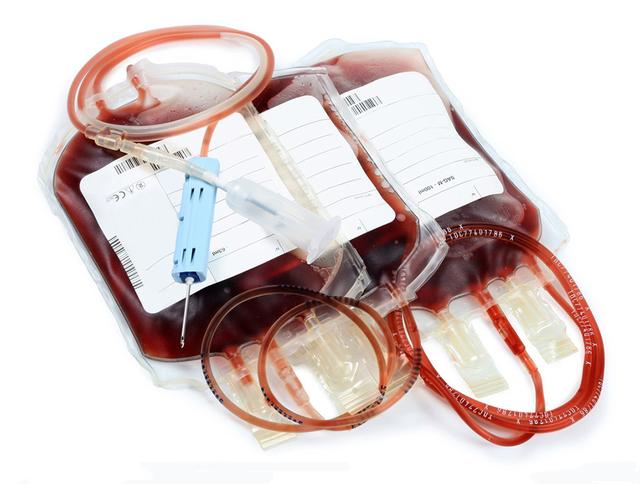 六种成分血输血,各自的注意事项护士需牢记-最