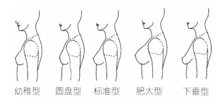 改善不完美胸型的五大方案