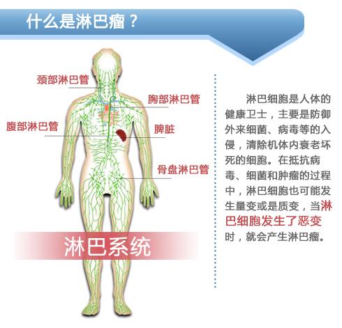 淋巴瘤