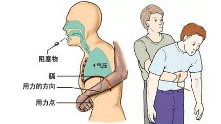 鼻子堵的原理_茜施妃雅小知识 鼻子毛孔堵塞怎么办 鼻子毛孔堵塞原因处理方法(2)