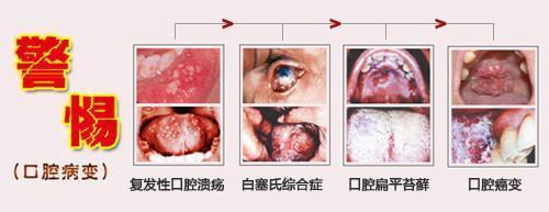 口腔疾病怎么办