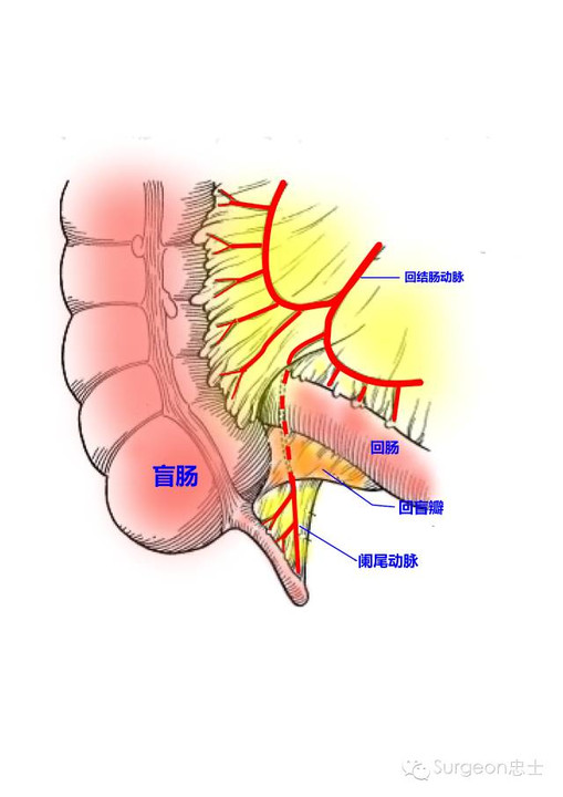 来源:surgeon忠士 局部解剖 脐上:观察孔;反麦氏点:主