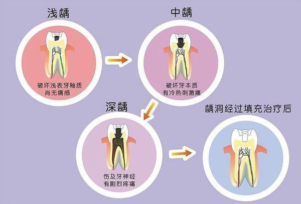 口腔疾病怎么办