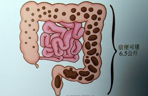 为啥腹部赘肉多?5个快速瘦腰法 缩腰缩胃缩脂