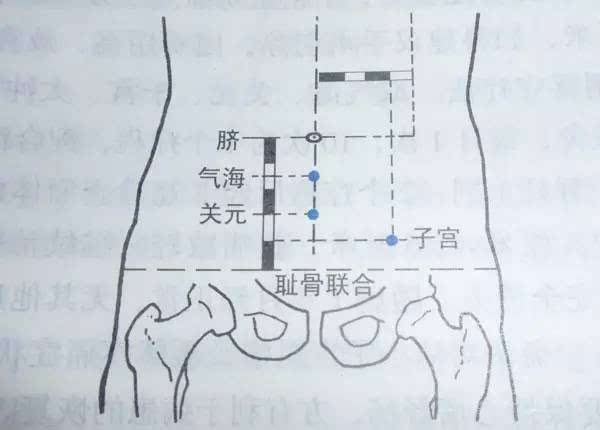 小腹左下方常一阵轻微疼痛,月经推迟,尿阴性,乳房胀痛