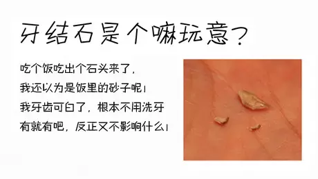 牙结石是个嘛玩意?