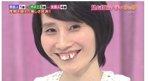 为什么日本人牙齿普遍不好看,这位一语道出真
