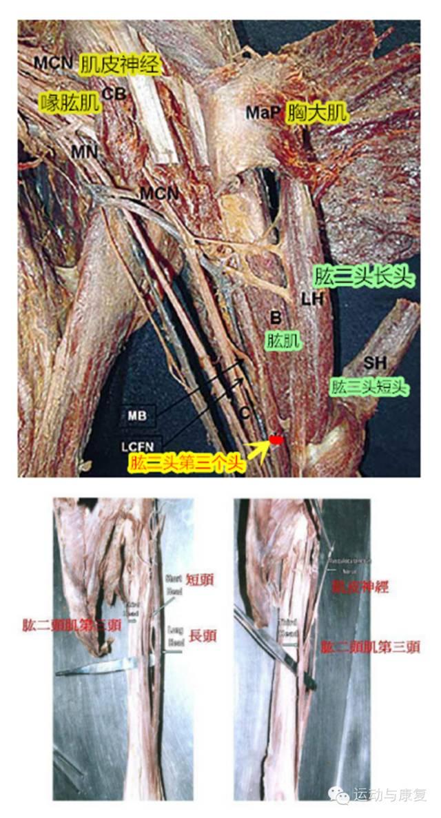 股五头肌,肱四头肌长这样!解剖原图,胆小勿入