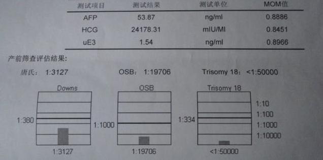 唐氏筛查的原理_每20分钟就有一个唐氏儿出生 孕妈妈产前筛查必不可少(2)