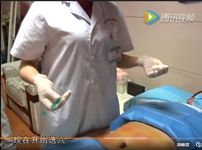 四川省泸州市中医院蛋白埋线减肥何谓穴位埋线疗法?