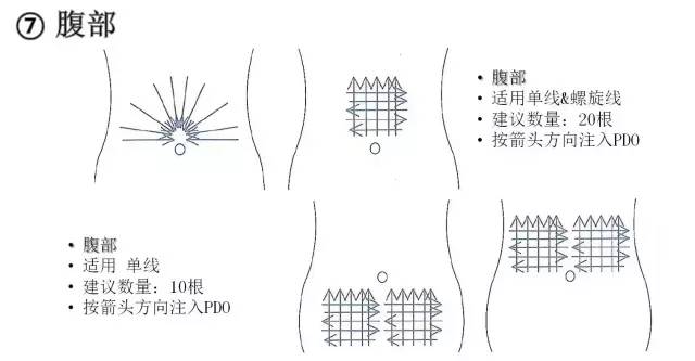 蛋白线提升的原理_蛋白线面部提升术的工作原理是什么(2)