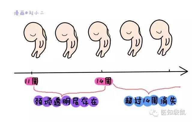 孕期B超都查什么?教你轻松看懂B超检查单