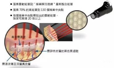 皮秒激光的原理和作用_皮秒激光切割玻璃的原理和工艺研究