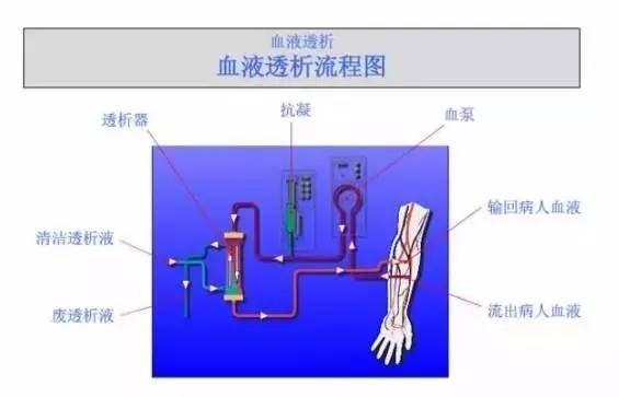 糖尿病的人透析是什么原理_什么是糖尿病图片(3)