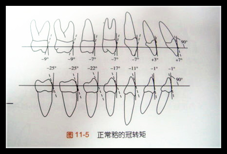正常的牙齿排列是这个样子,看看你的是否正常?
